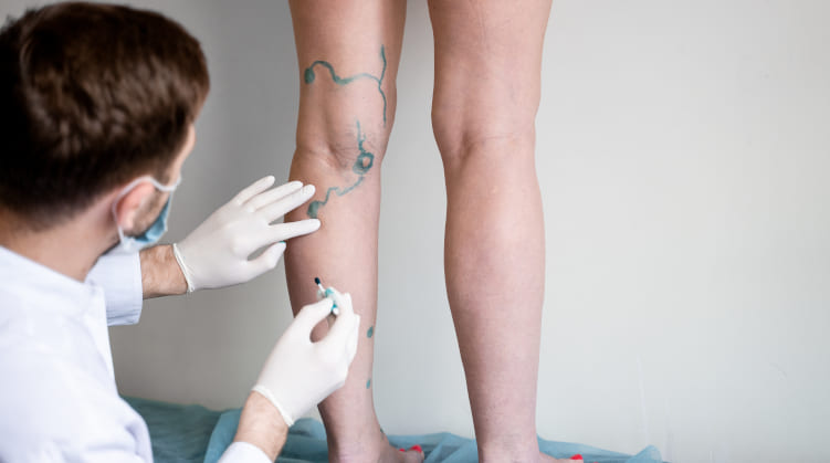 Ilustrasi sirkulasi darah di kaki manusia